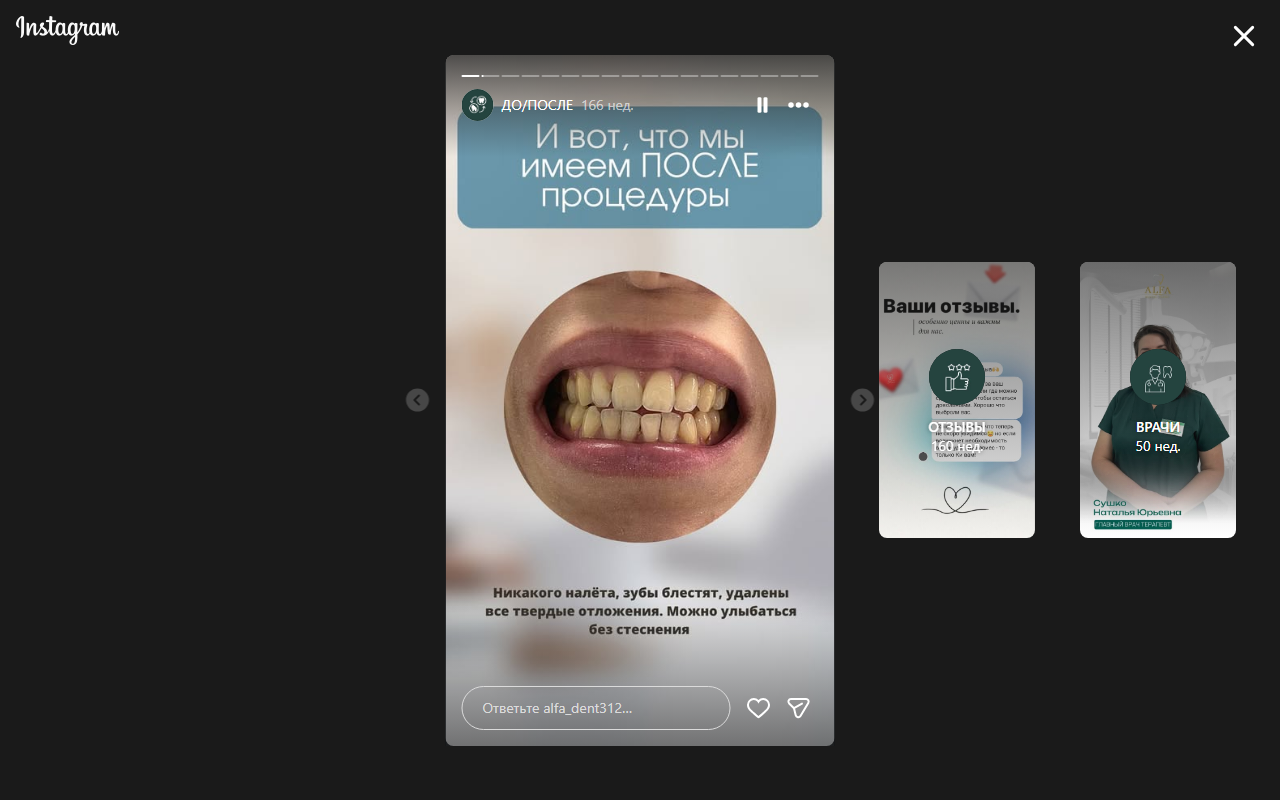 До чистки зубов