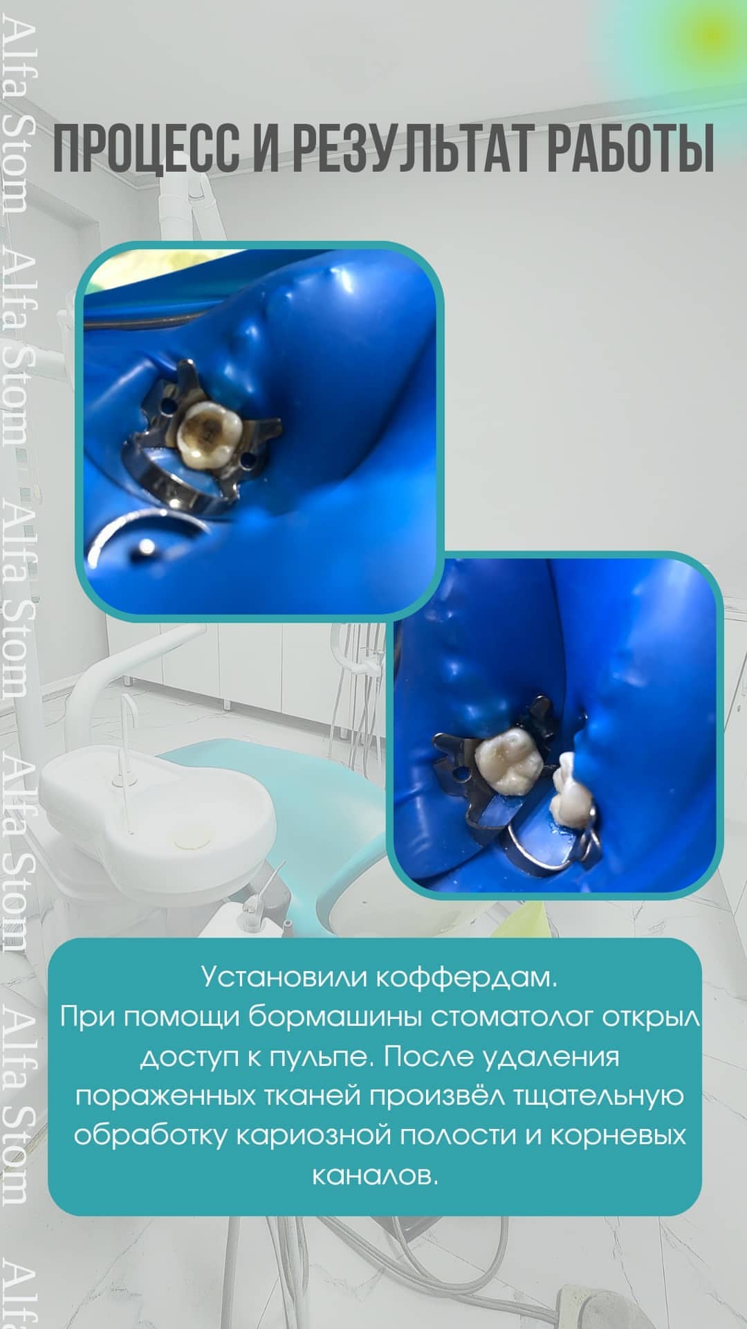 ДО/ПОСЛЕ — хирургия