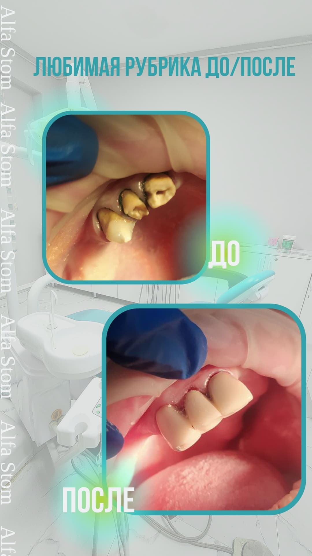 ДО/ПОСЛЕ — результат лечения