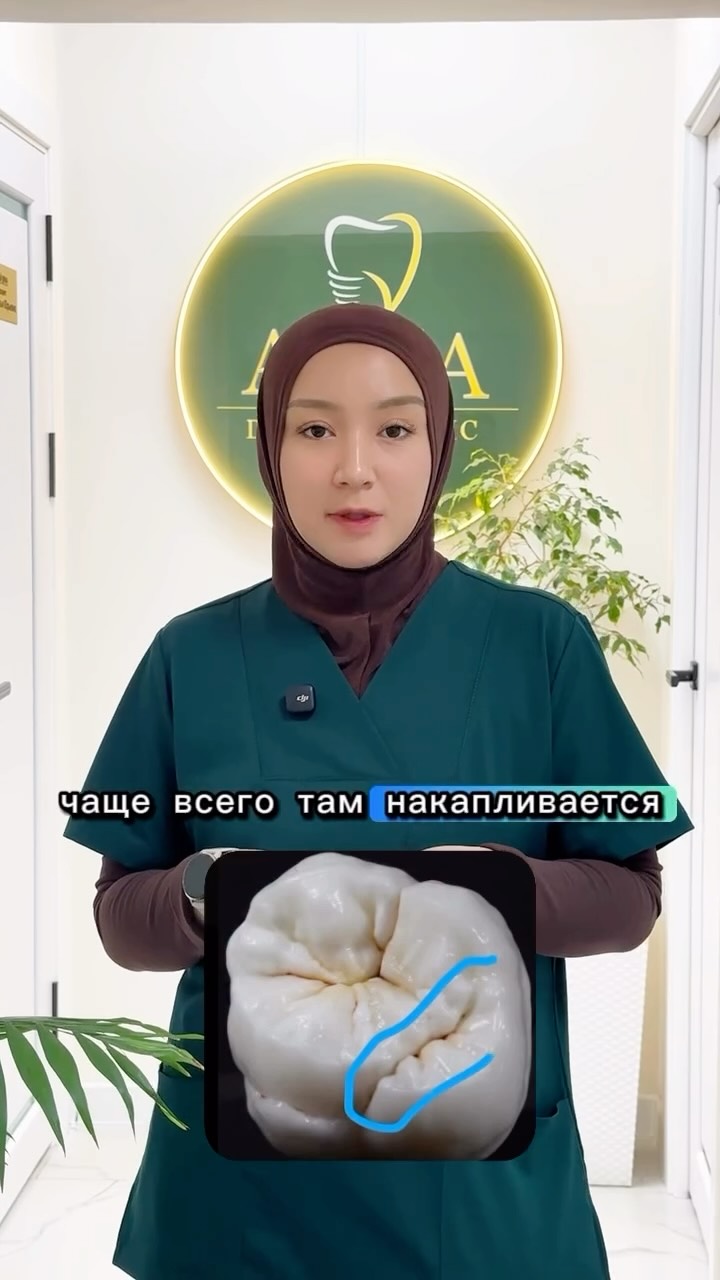 Герметизация фиссур