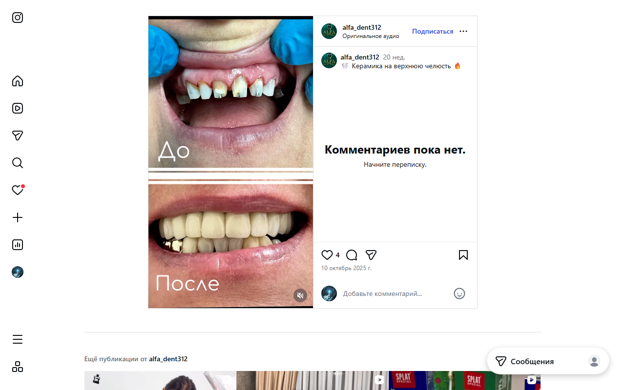 Керамика и коронки